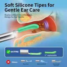 Wireless HD Ear Cleaning Gadget
